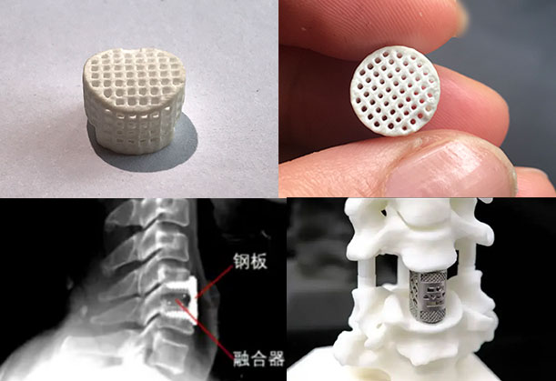 Application of interbody fusion cage in repair of bone defect of animal or human body